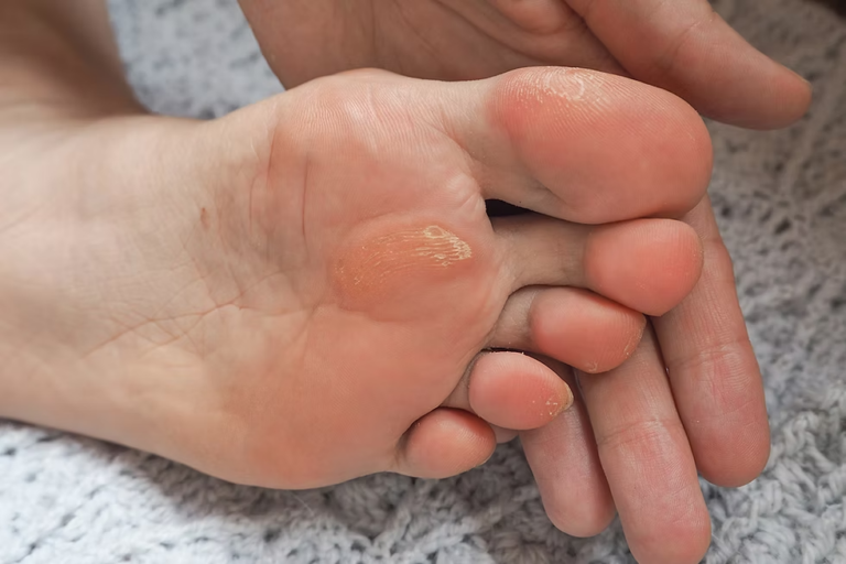 Common Foot Problems and Treatments